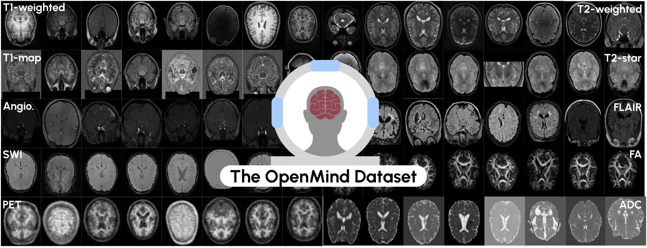 OpenMind Dataset
